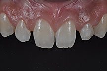 Odontologia Estética