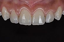Odontologia Estética