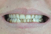 Odontologia Estética