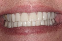 Odontologia Estética