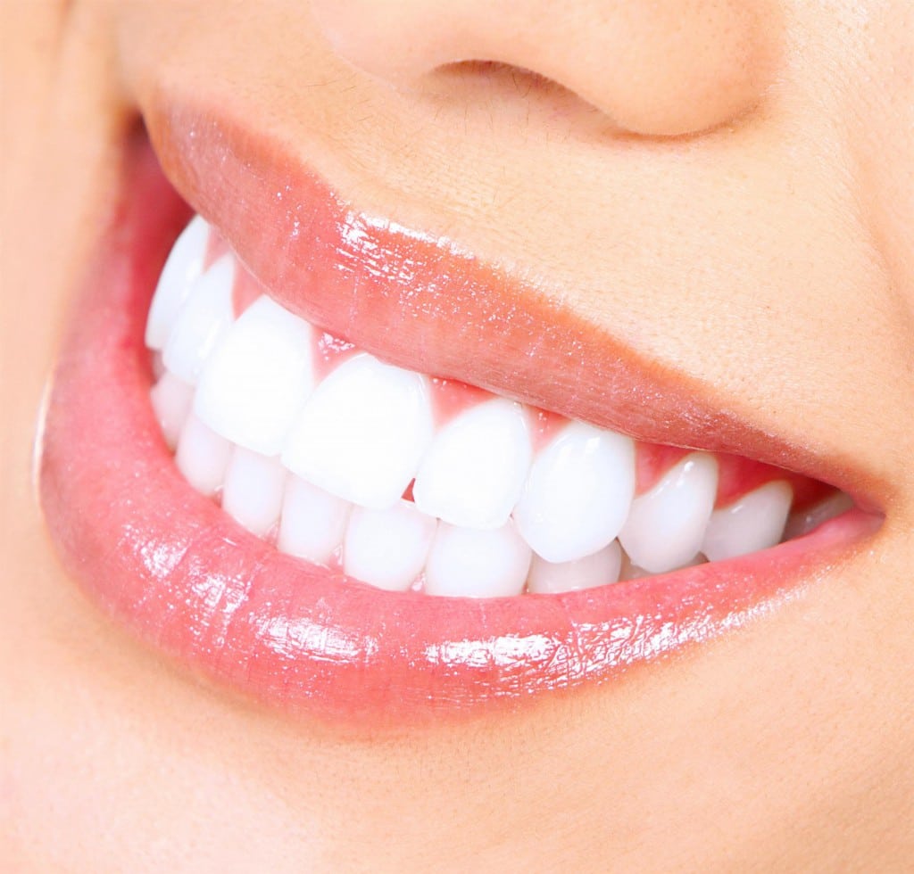 sorriso branco