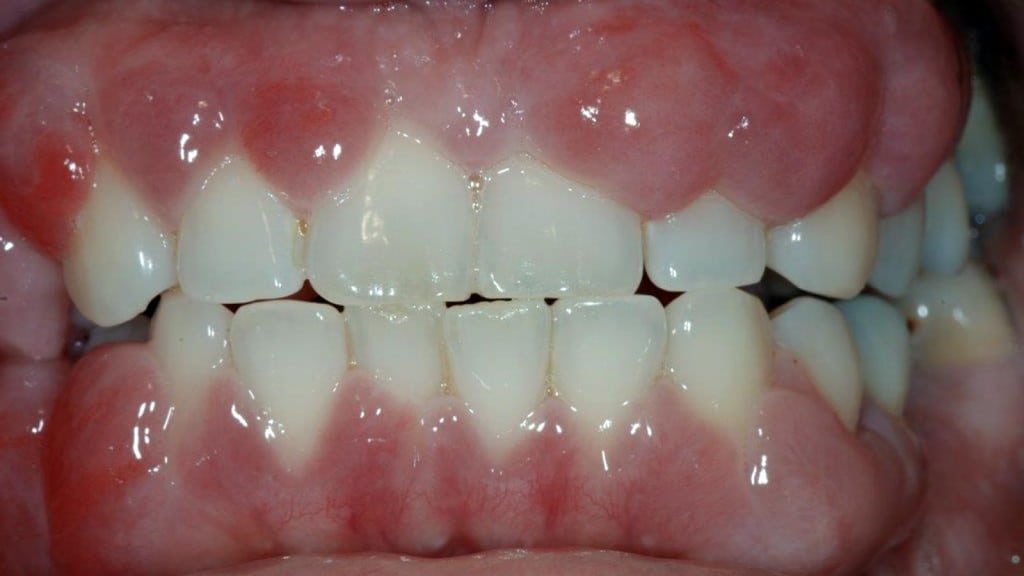 image1 (5)
