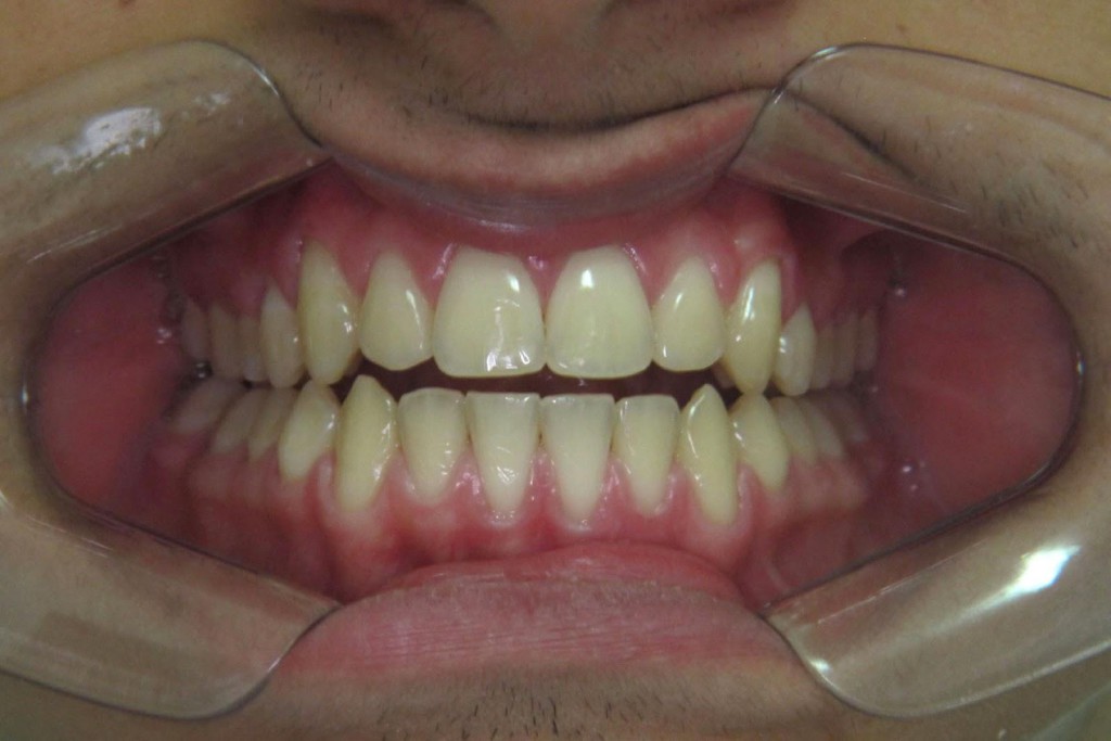 image2